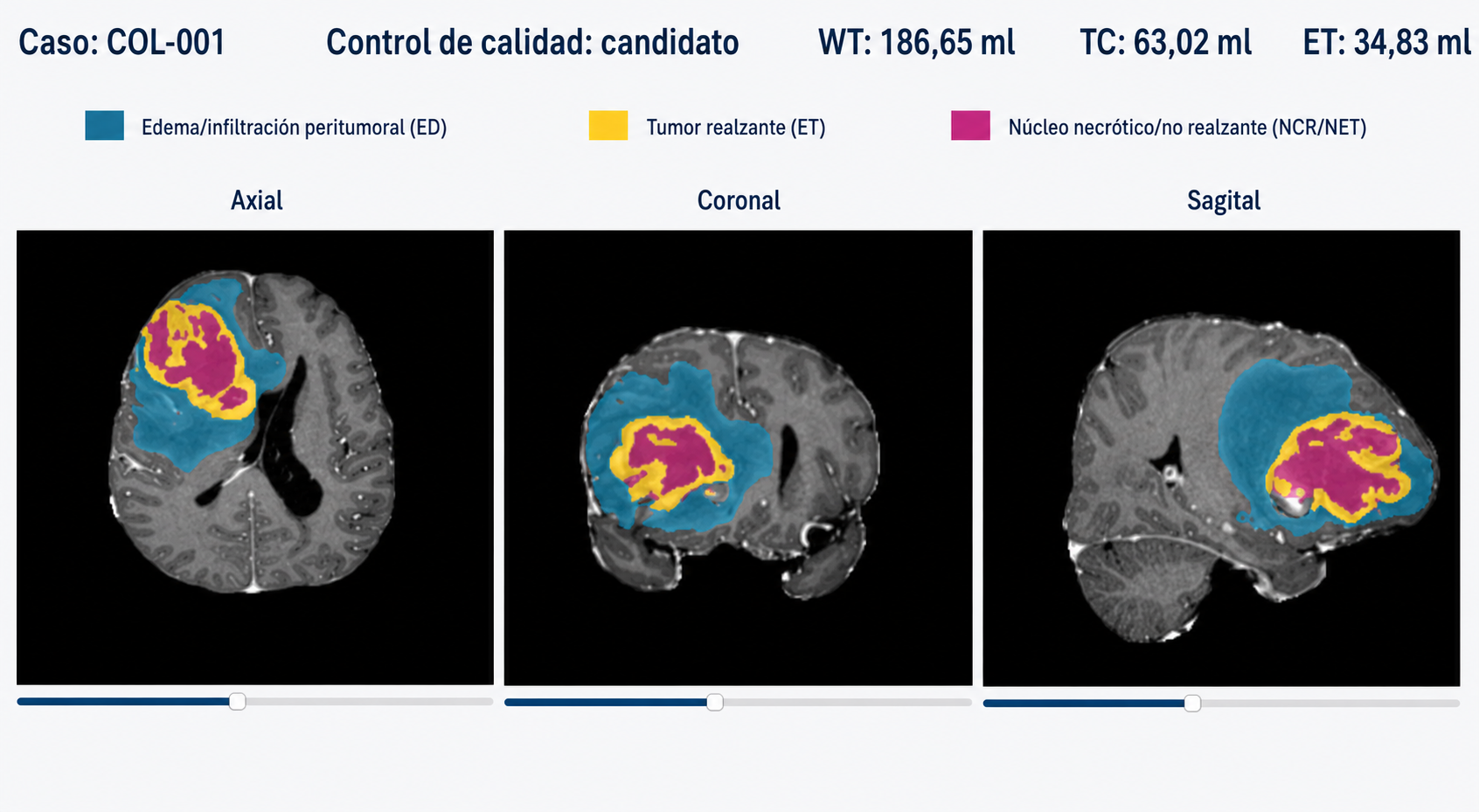 COL-001 · Segmentación